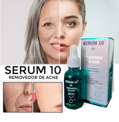 Anti Acne - Serum 10 + Envio Gratis